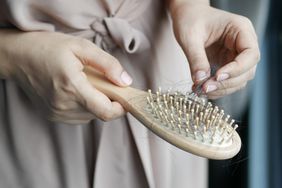 Women hold her lost hair close up